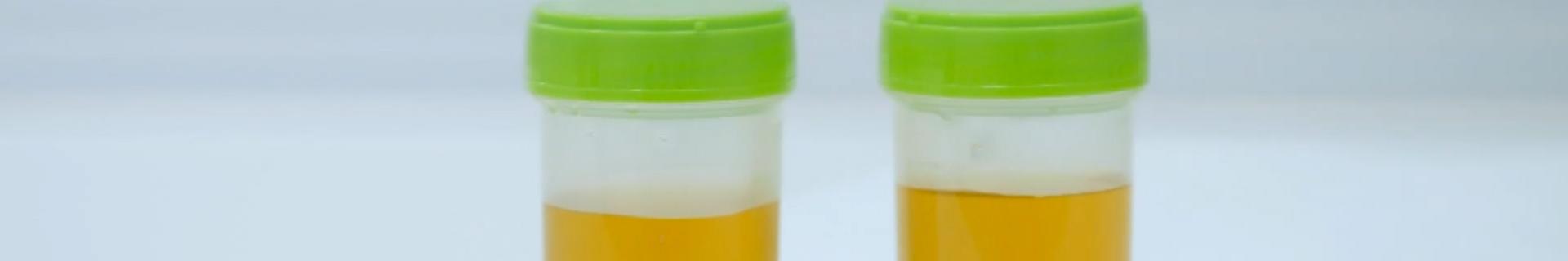 DOT “Reasonable Suspicion” Testing Overview for Managers and Supervisors