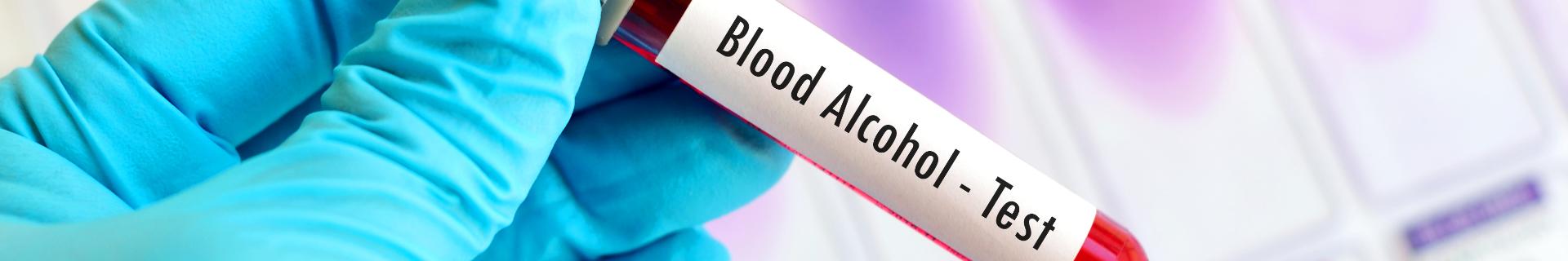 Drug and Alcohol Testing for CDL Drivers