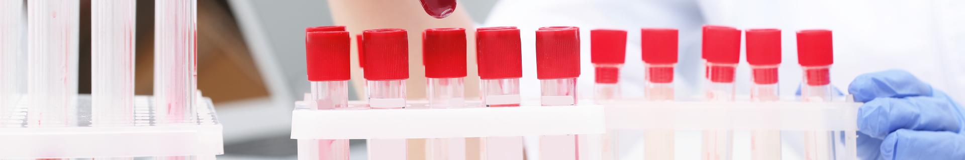 Bloodborne Pathogens